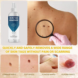 Skin Tag Remover 100 ml Pack of 2 Beauty & Personal Care