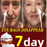 Eye Repair Cream (Pack of 2) Beauty & Personal Care