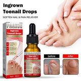 Ingrown Toenail Drops 60 ml Pack of 2 Beauty & Personal Care