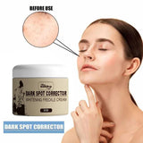 Dark Spot Corrector Whitening Frackle Cream 50g Beauty & Personal Care