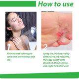 Corn Removal Spray 120ml Pack of 2 Beauty & Personal Care