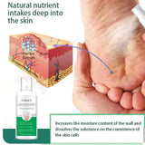 Corn Removal Spray 120ml Pack of 2 Beauty & Personal Care