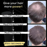 ELLHOY Magic Colour Hair Concealer Spray 100ML (Pack of 2) Beauty & Personal Care