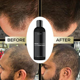 ELLHOY Magic Colour Hair Concealer Spray 100ML (Pack of 2) Beauty & Personal Care